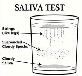Saliva Test for yeast infection