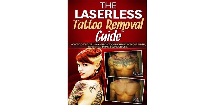 The Laserless Tattoo Removal Guide by Dorian Davis review