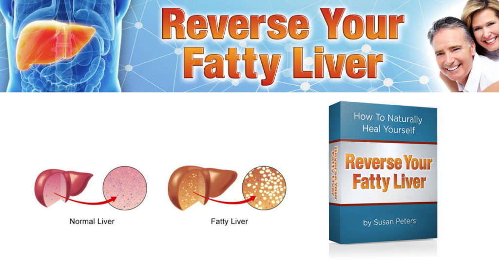 Reverse Your Fatty Liver By Susan Peters Review