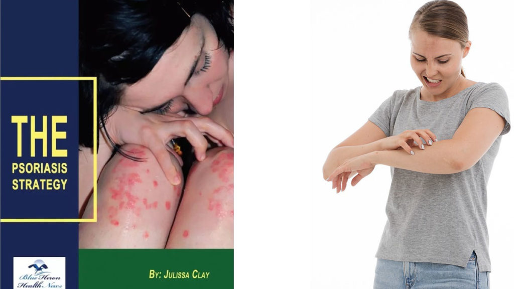 What is Psoriasis Strategy