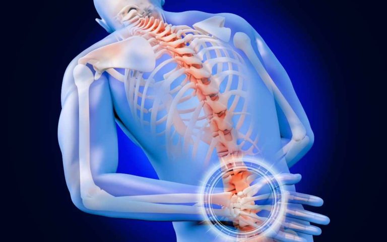 Conventional Treatments for Back Pain