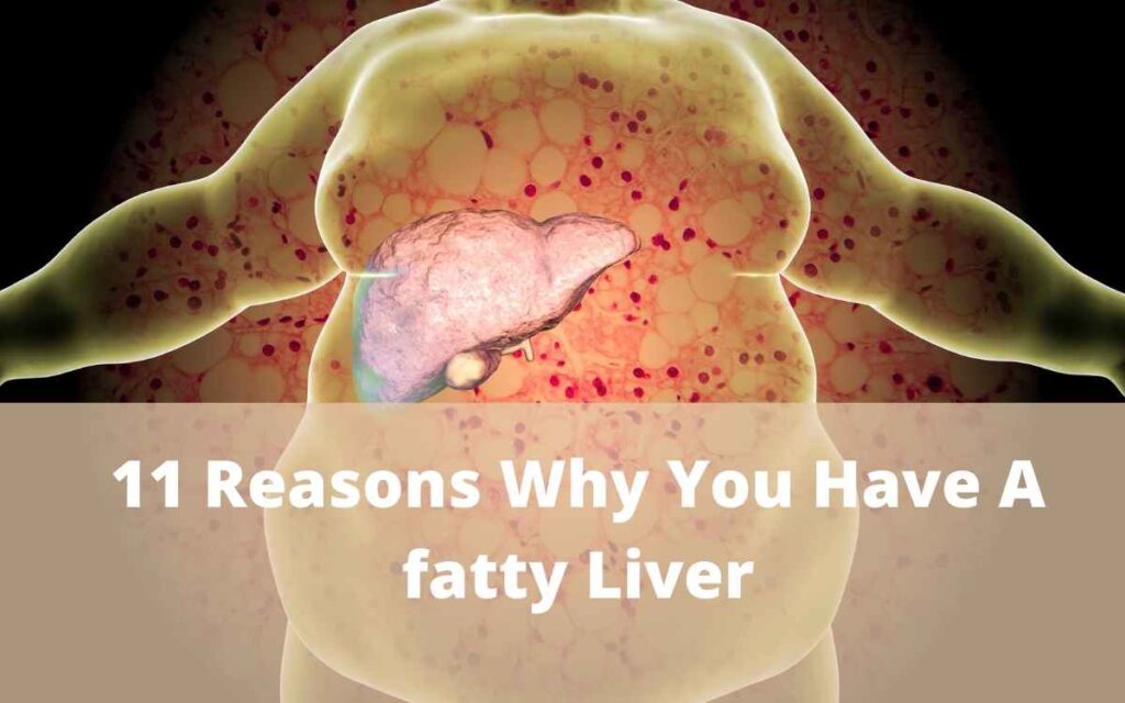 11 Reasons Why You Have A fatty Liver: Most Common Symptoms