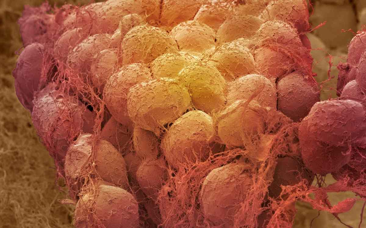 What is Brown Adipose Tissue?