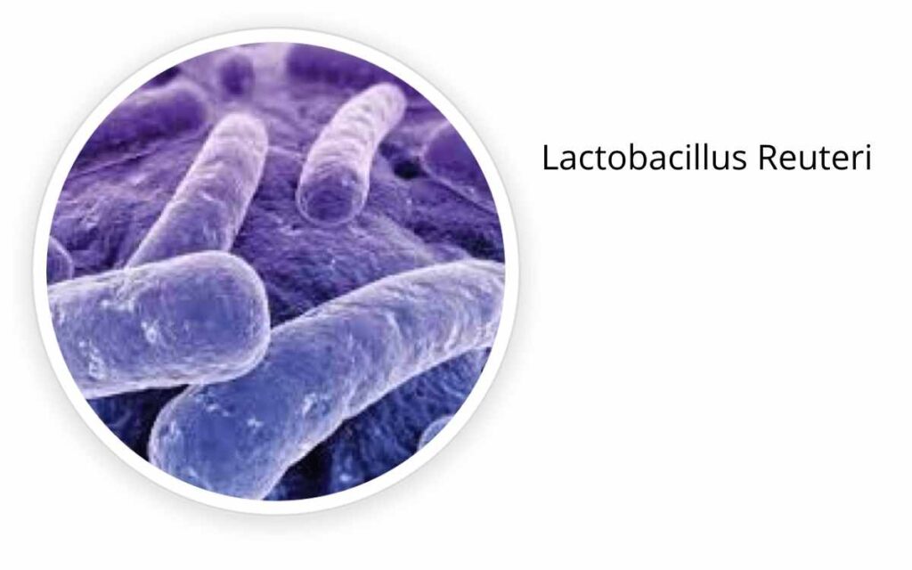 Lactobacillus paracasei