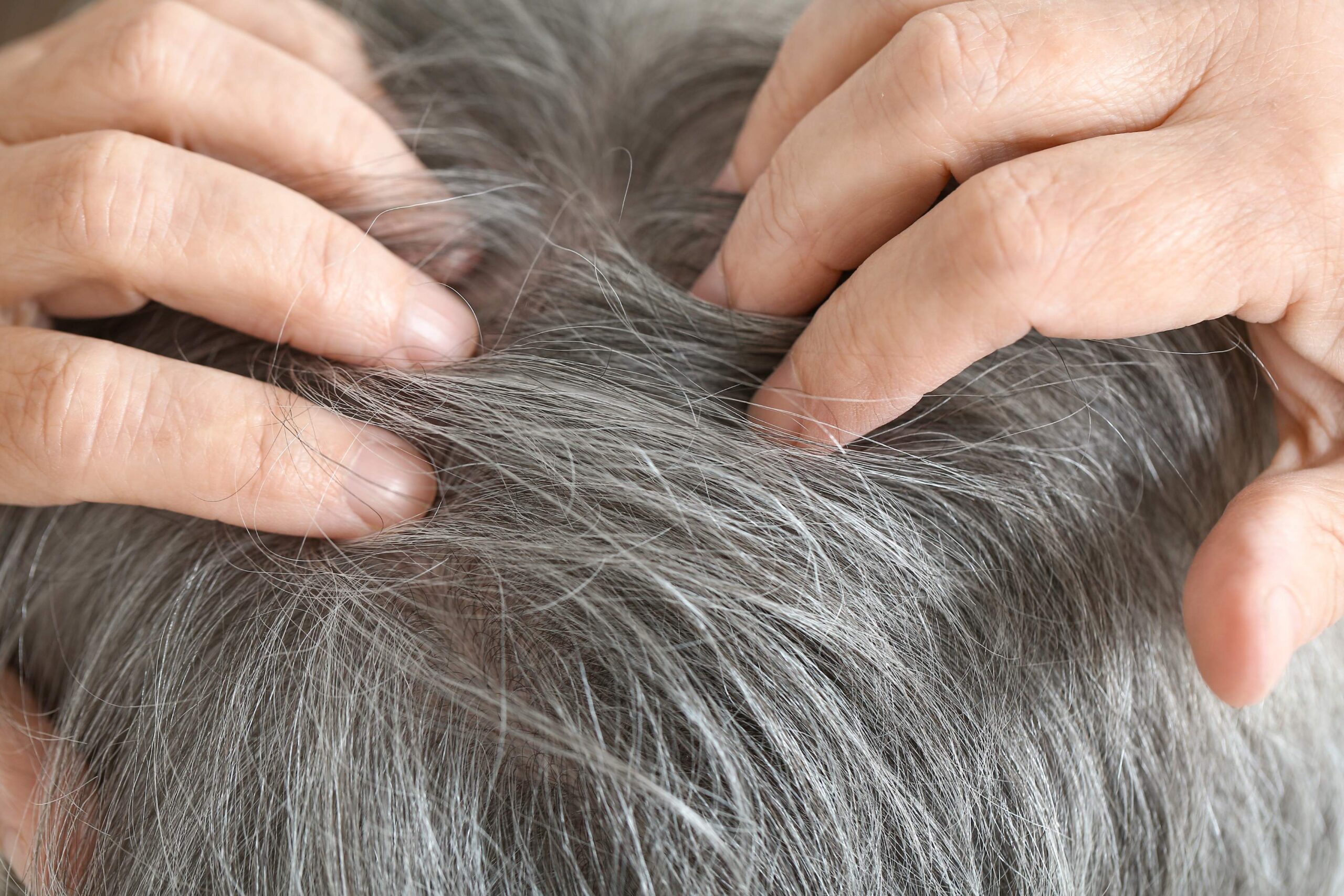 How To Moisturize Dry Gray Hair