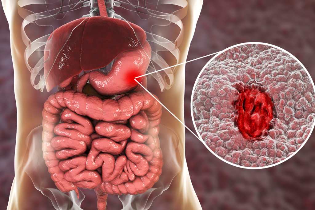 Gastrointestinal System