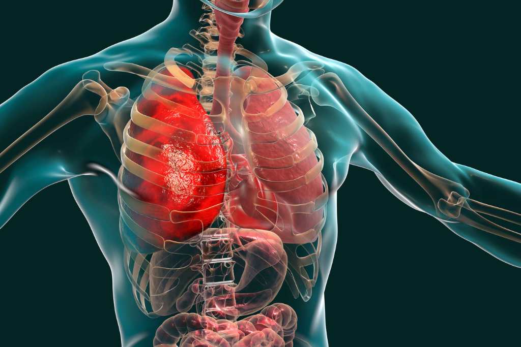 Respiratory System