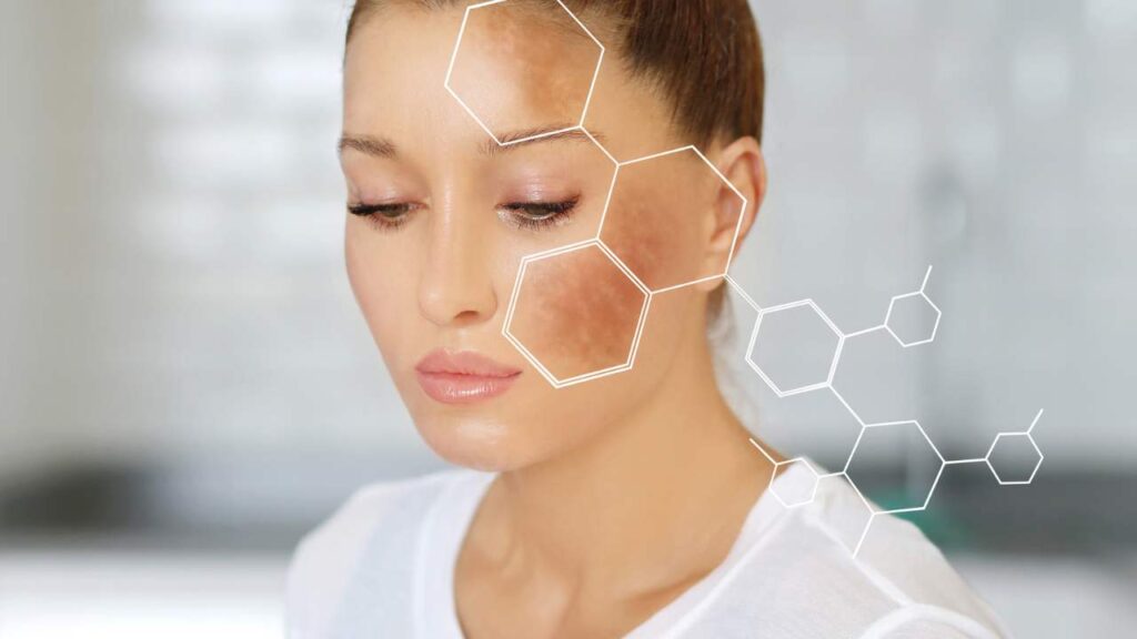 How Illuderma Helps with Dark Spots: A Closer Look