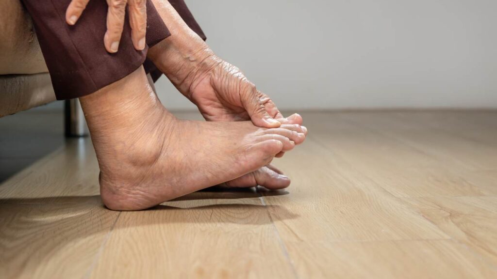 Living with Gout: Daily Challenges and Triumphs