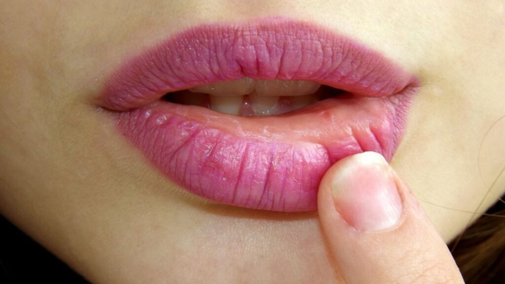 Can TMJ Cause Lip Numbness
