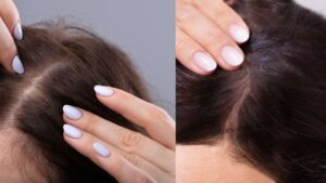 FullyVital Hair Serum Review: