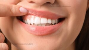 My 30-Day Journey With ProvaDent: Is It Safe?