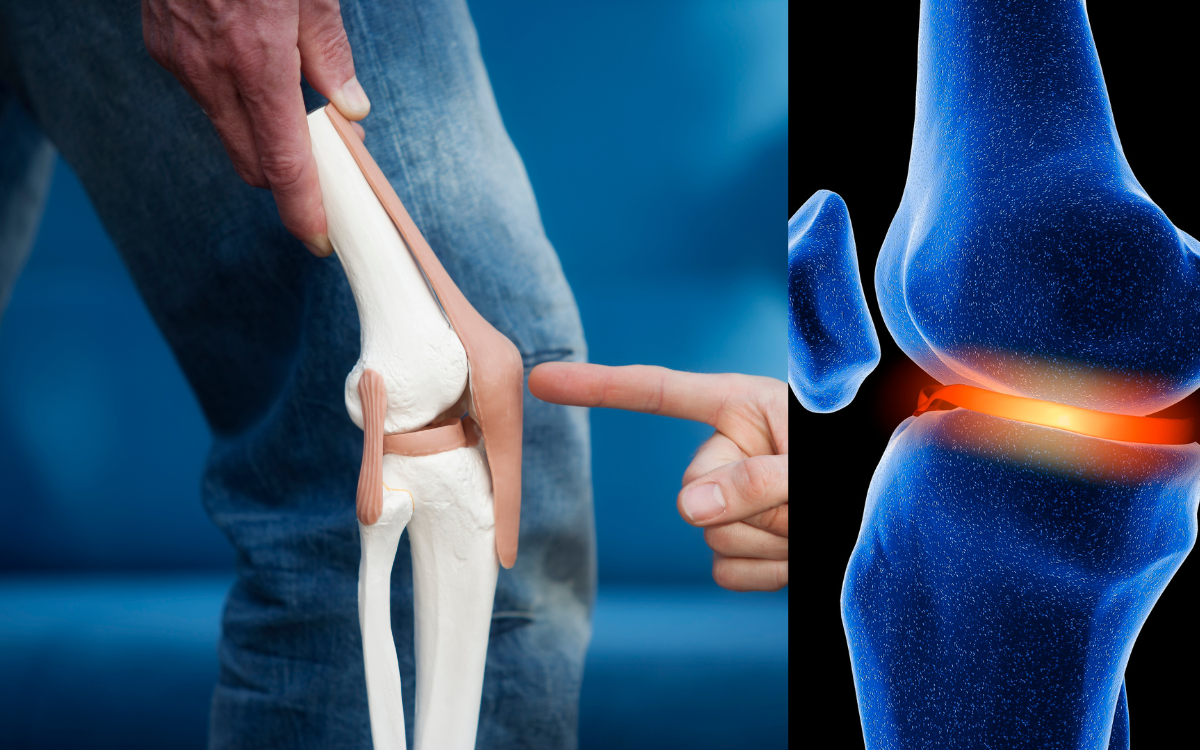 How To Repair Cartilage Naturally: