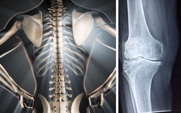How To Strengthen Bones And Joints Naturally