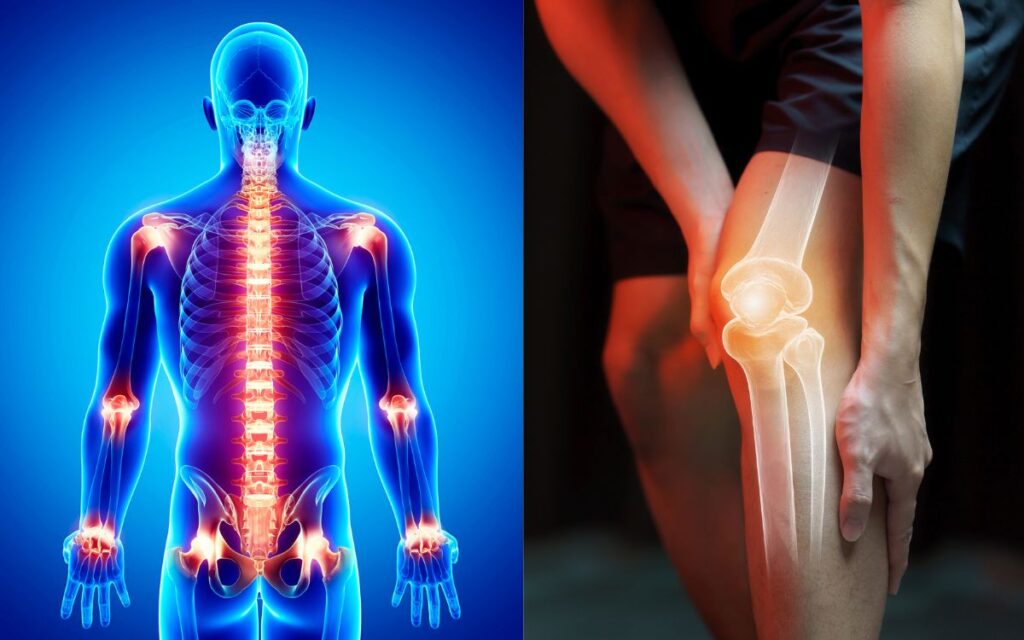 What Breaks Bones?