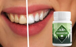 Oradentum Review: Does It Really Work?
