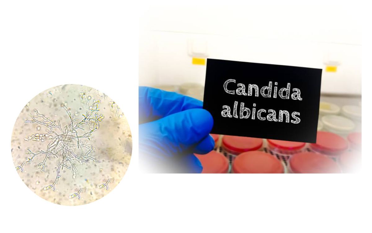 Can Estrogen Cause Yeast Infections?