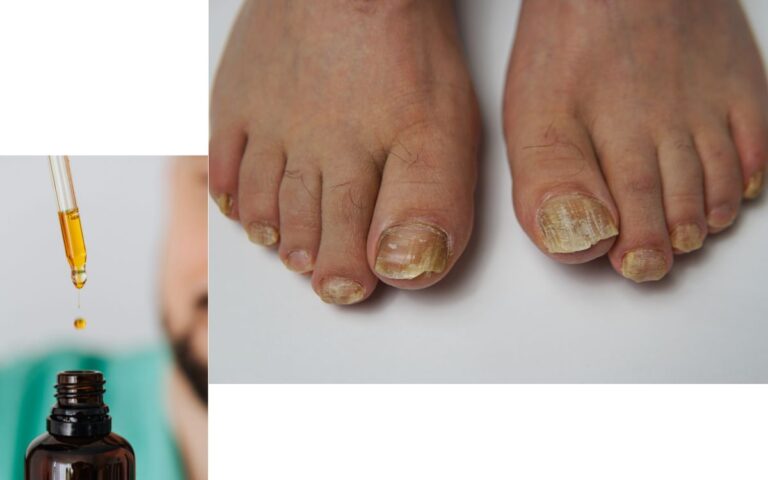 Does Metanail Serum Pro Work?