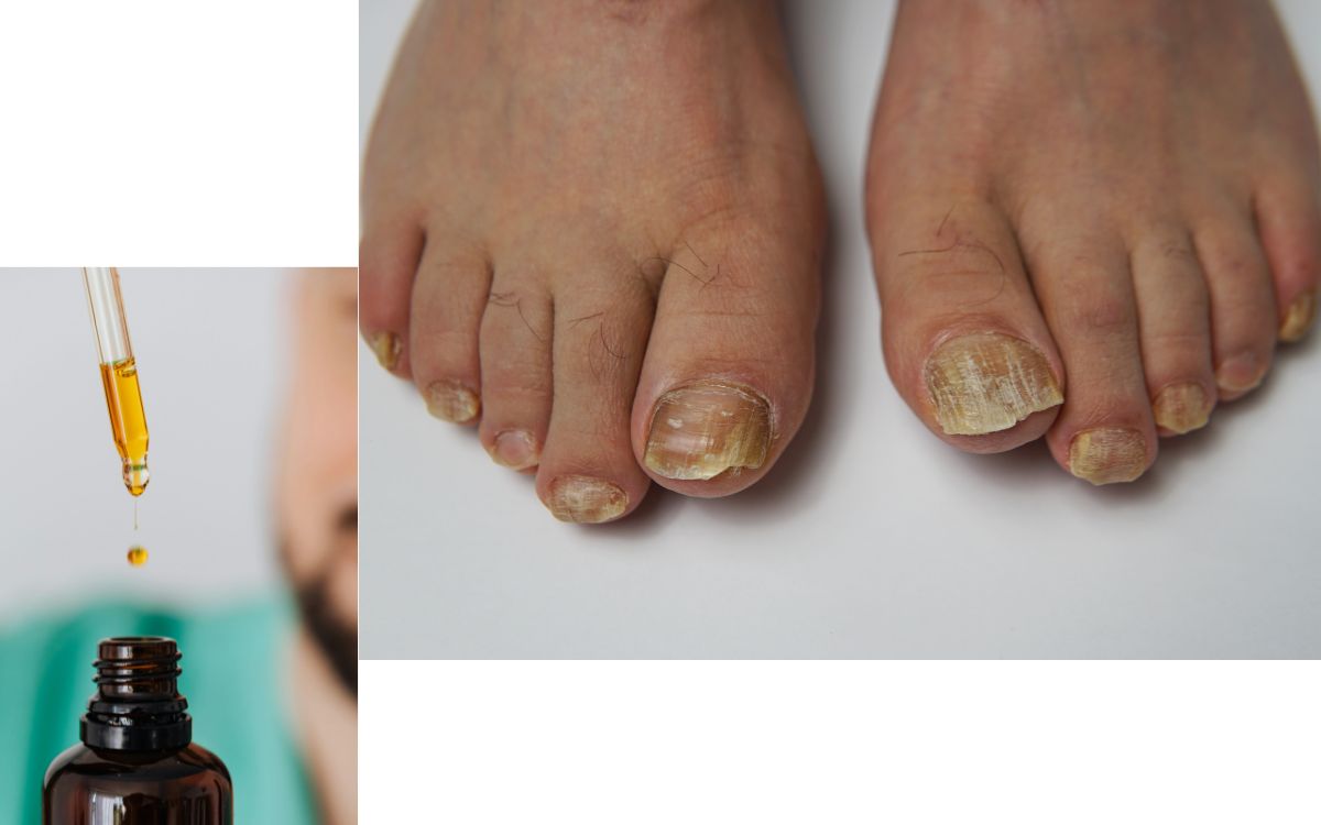 Does Metanail Serum Pro Work?