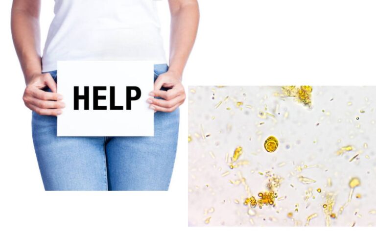 How To Get Rid Of a Yeast Infection In 24 Hours