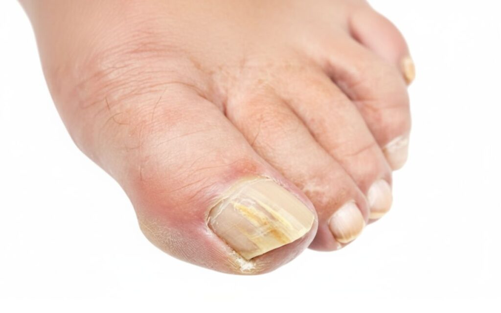 The First Few Weeks: The "Nothing Burger"