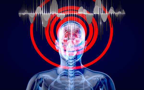 12-Minute Solara Switch Audio